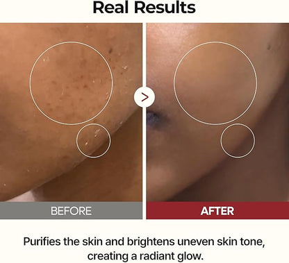 Luminous Glow Rice Peel Ampoule